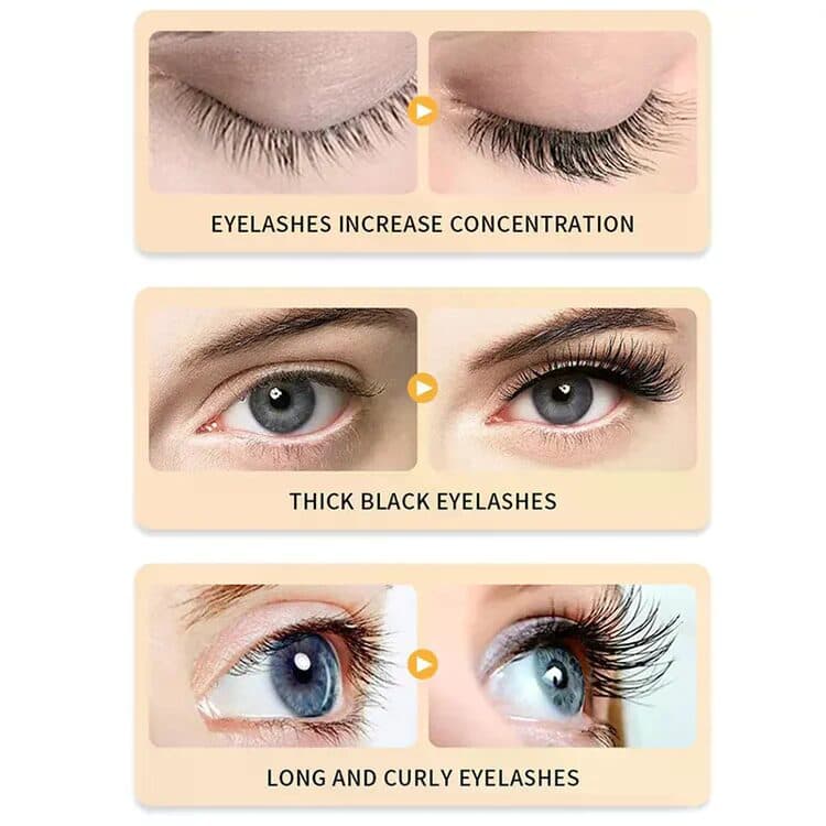 Eyelash Growth Serum - Fuller, Longer &amp; Thicker Lashes (Fast Results)