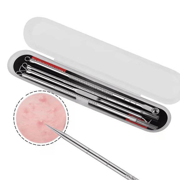 Pimple Extractor Tool Set (4pcs) - Blackhead &amp; Whitehead Remover Kit
